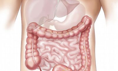 Gastroshizia
